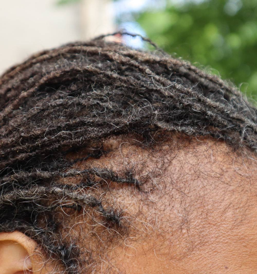 Close-up of scalp showing hair regrowth after using What Naturals Love Hair Serum. Strengthens hair and prevents breakage.