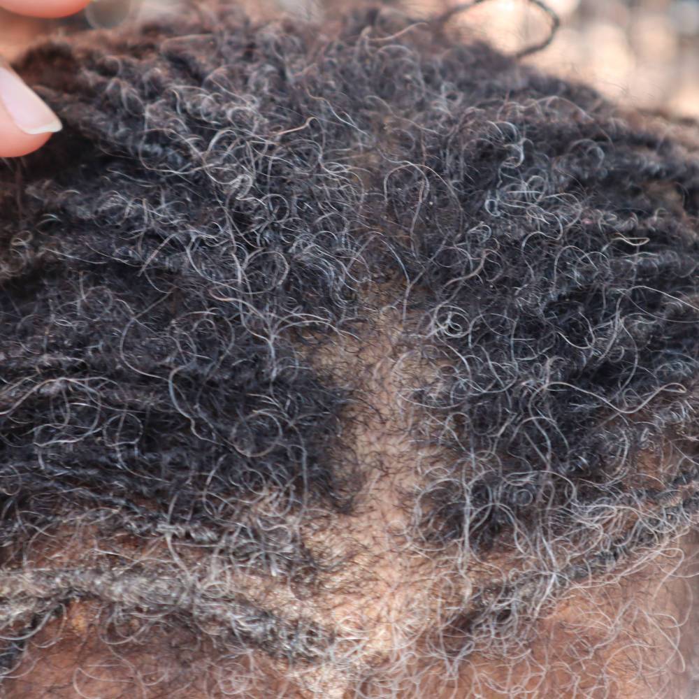Close-up of scalp with visible hair regrowth after using What Naturals Love Hair Serum. Strengthens locs and prevents breakage.