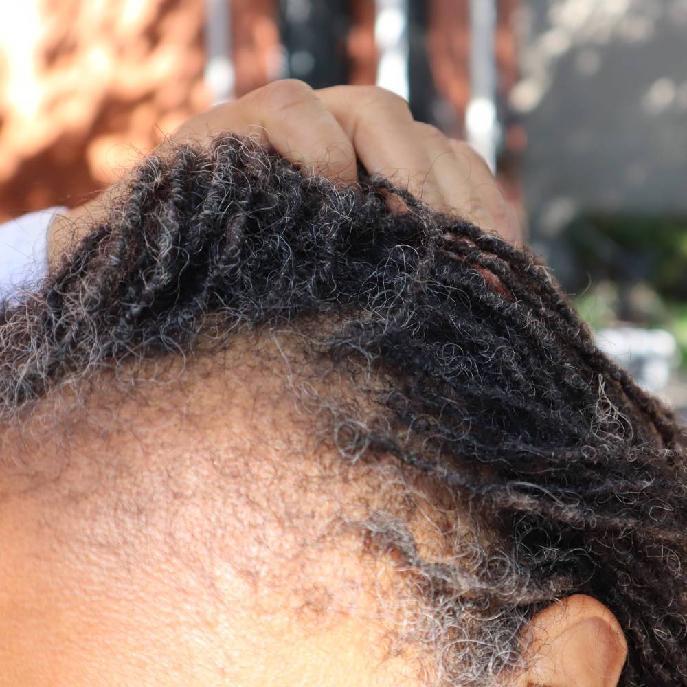 Hand lifting hair to show thinning edges before using What Naturals Love Hair Serum. Hydrates scalp and promotes natural growth.
