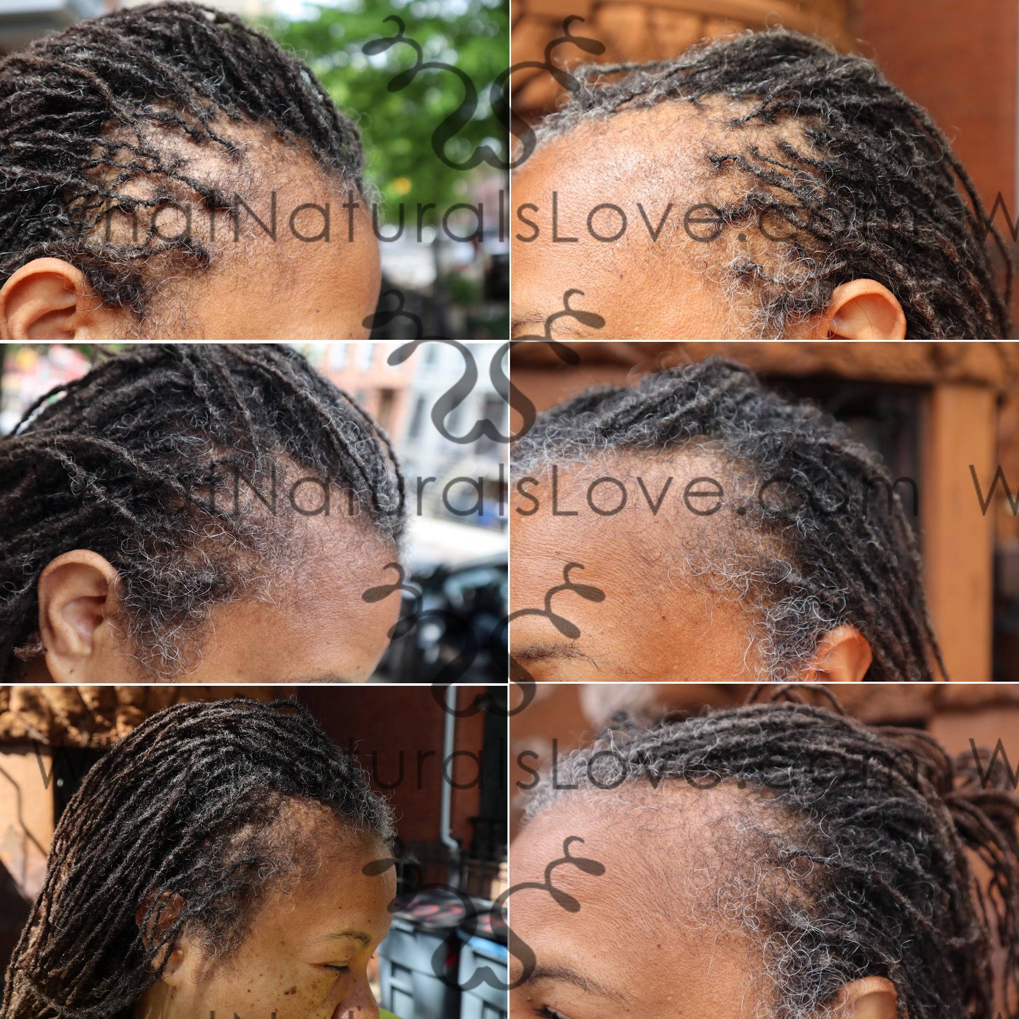 Before and after images of hair growth using What Naturals Love Hair Serum. Strengthens locs, hydrates scalp, and promotes healthy hair.