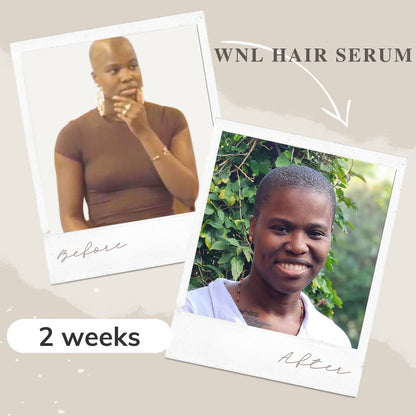 Danitsa na 2 weken gebruik van de WNL Haarserum