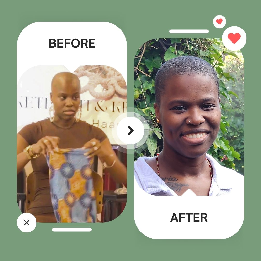 WNL Serum voor Haargroei